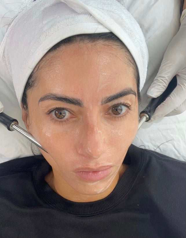Forget Botox, Microcurrent Is What You Need